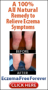 What Can Cure Eczema